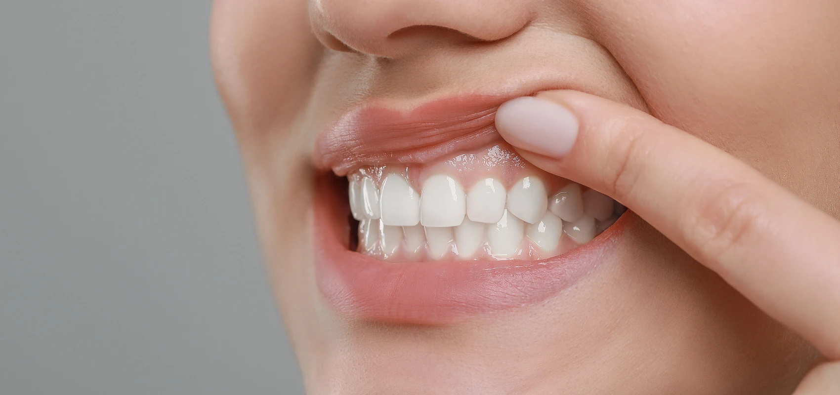 Soin de gencives | Greffe de gencive | Dentiste Paris 17 Soin de gencives Paris